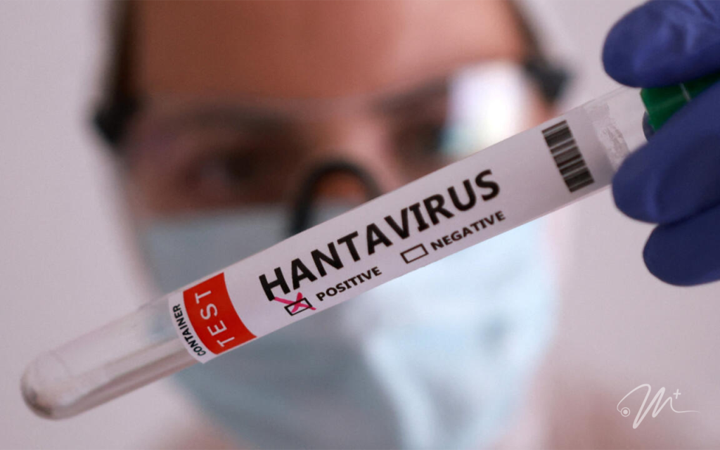 Hantavirus en Valles del Tuy | Síntomas, Contagio y Prevención
