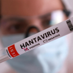 Hantavirus en Valles del Tuy | Síntomas, Contagio y Prevención
