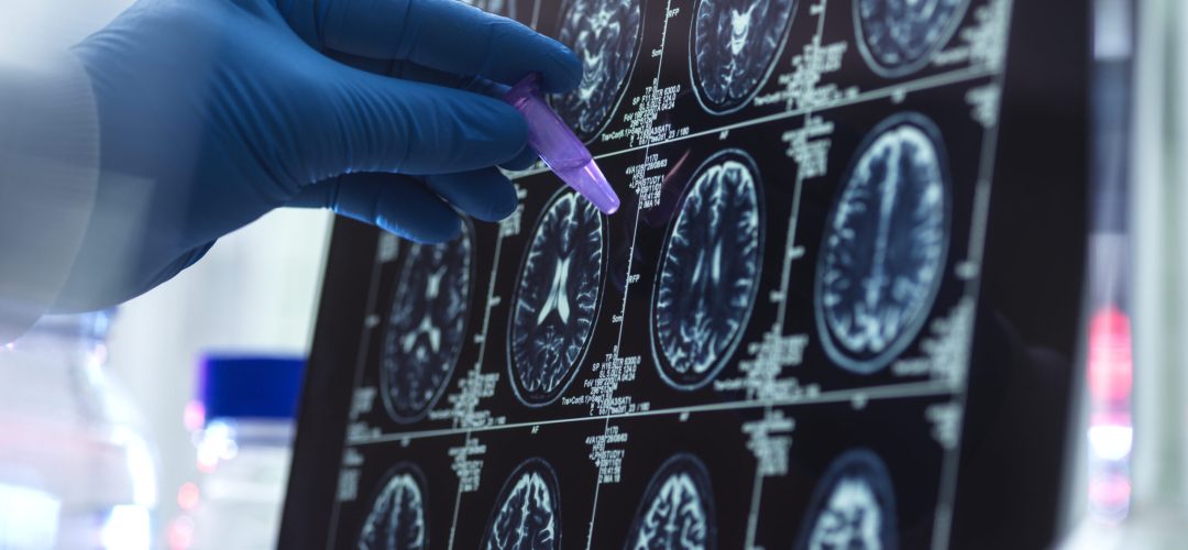 Visualización de imágenes por estudios avanzados Medicare Plus